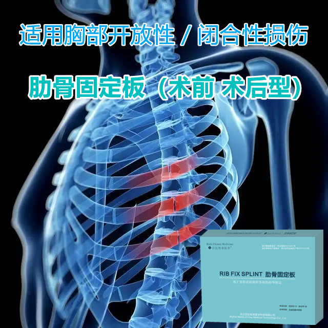 1764045840856079.jpg 胸骨固定板1.jpg