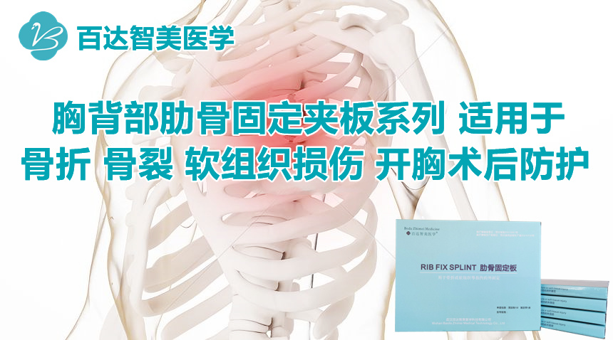 1767927321987430.jpg 胸骨固定板_副本.jpg