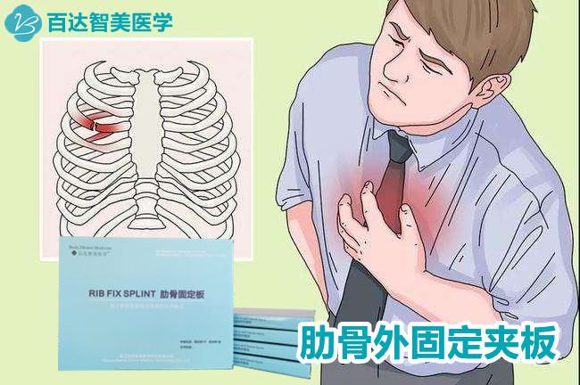 1774835503323339.jpg 肋骨固定板3_副本.jpg