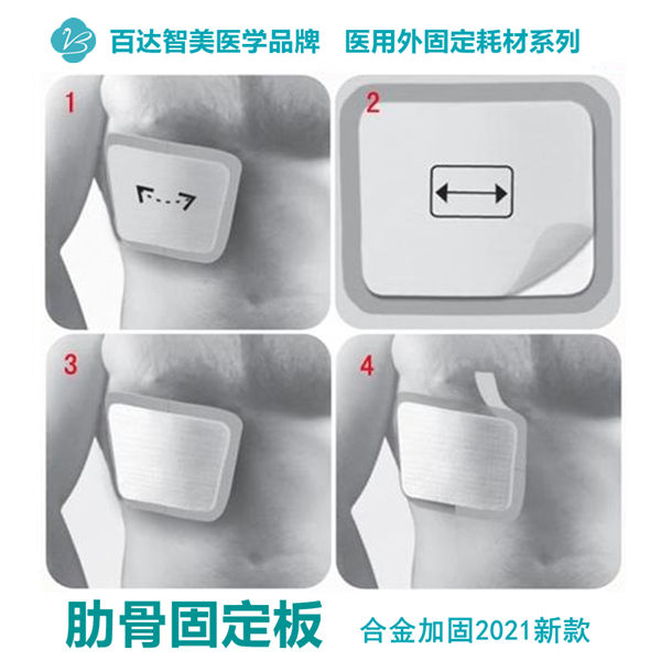 1778648149700118.jpg 百达智美医学肋骨固定板_副本_副本.jpg
