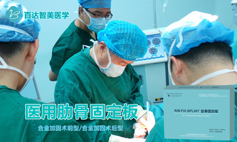1781764758558644.jpg 肋骨固定板_副本 (2).jpg