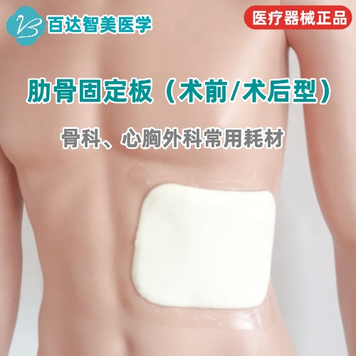 1788917304294487.jpg 肋骨固定板99_副本.jpg